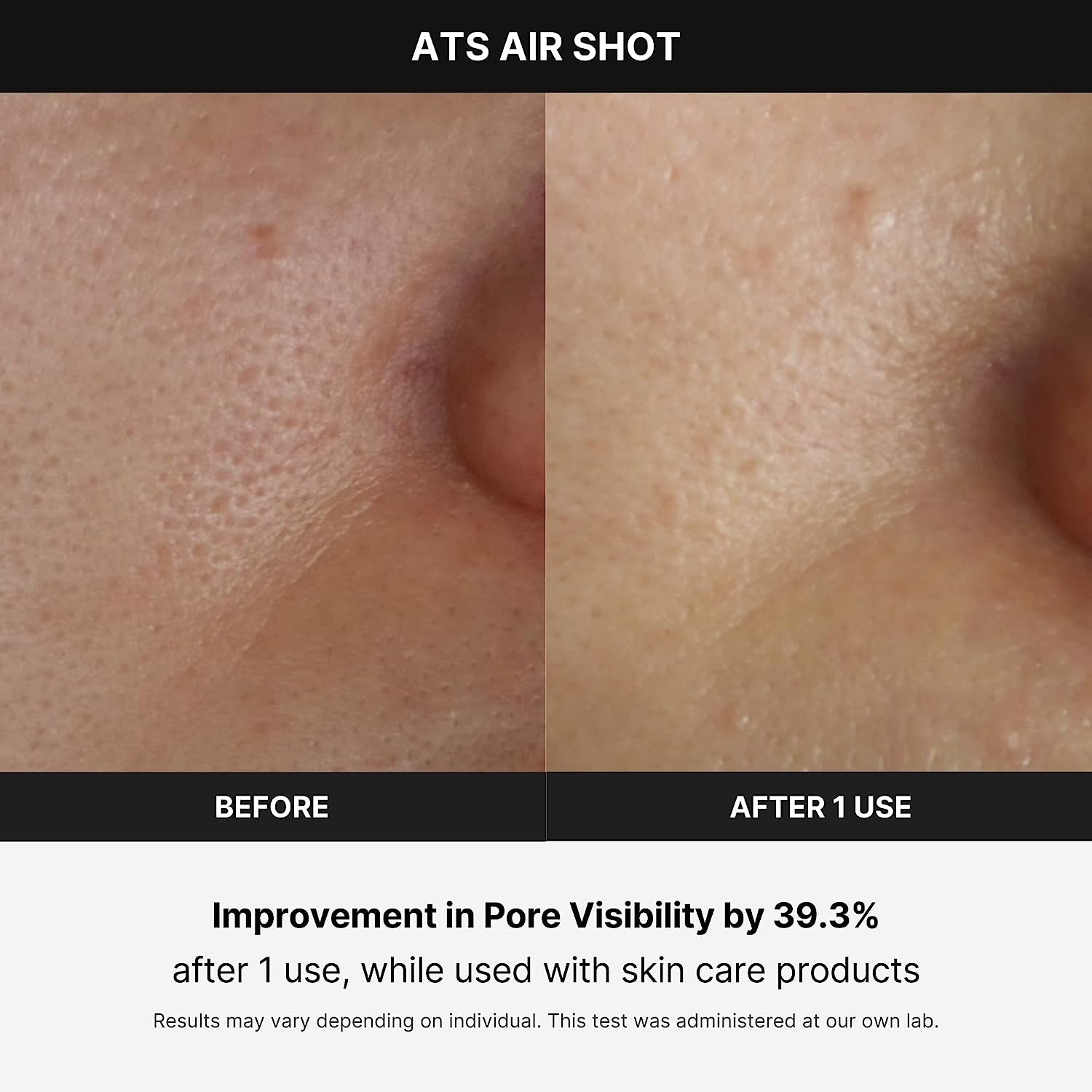 SkinLift Air / PoreTight Pro / NeedleGlow Shot / RejuvAir Device / K-Glow Microneedler / FreshLift Pulse / GlowStream Air / DermaShot Pro / SkinVibe Air / AirTight Glow / VelvetaSkin Device / ClearLift Mini / PulseDerm ATS / SmoothMist Pro / LumiPore Air