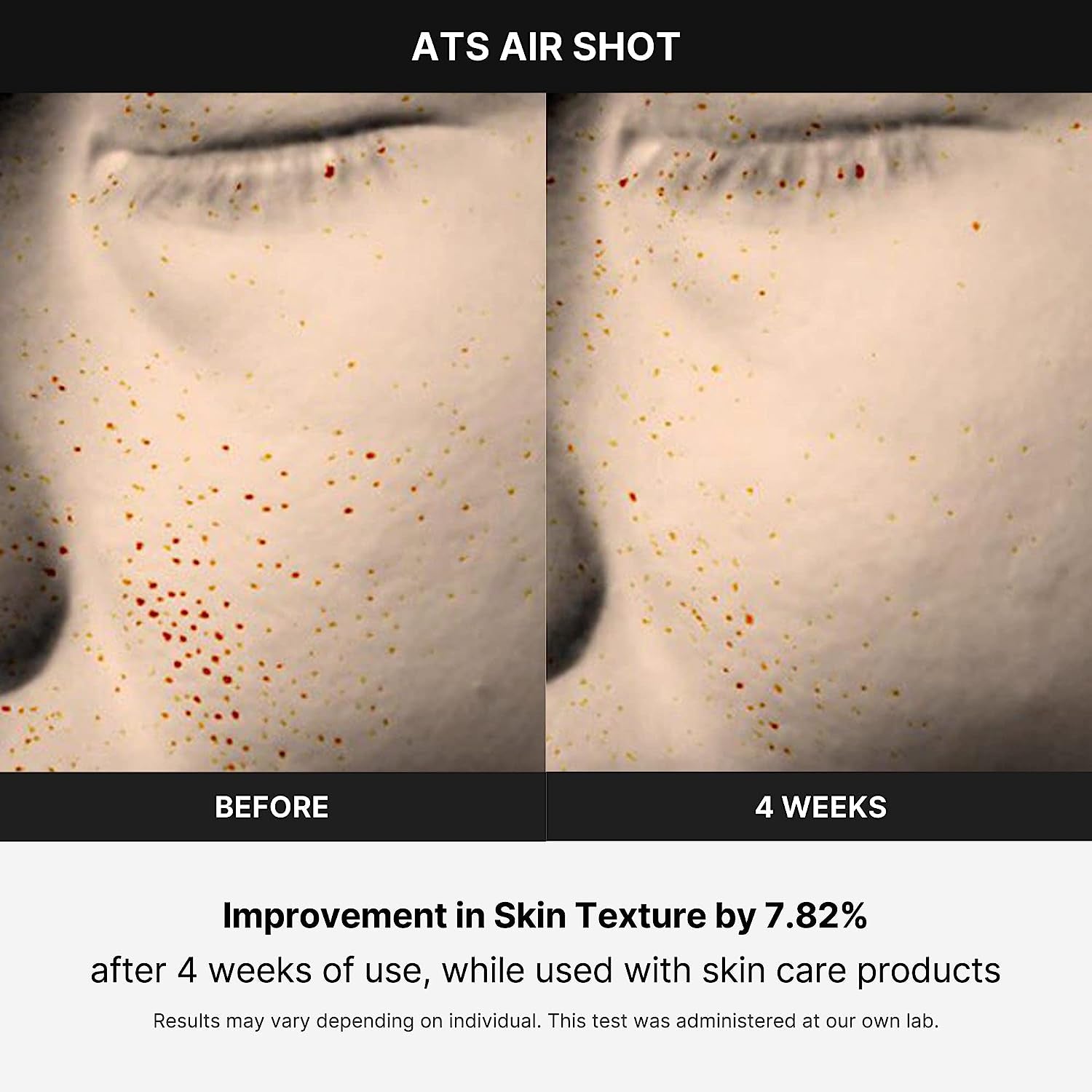 SkinLift Air / PoreTight Pro / NeedleGlow Shot / RejuvAir Device / K-Glow Microneedler / FreshLift Pulse / GlowStream Air / DermaShot Pro / SkinVibe Air / AirTight Glow / VelvetaSkin Device / ClearLift Mini / PulseDerm ATS / SmoothMist Pro / LumiPore Air