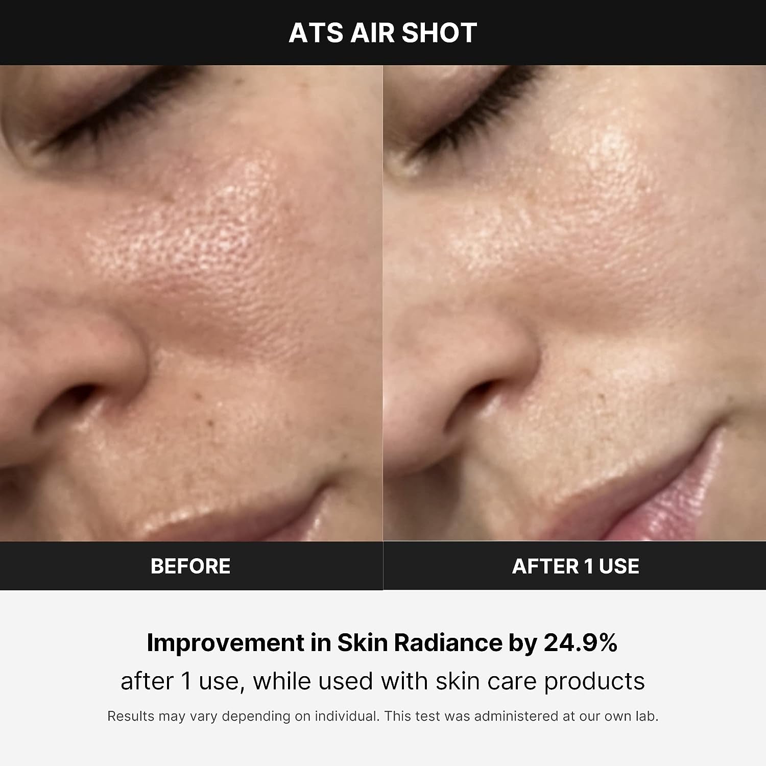 SkinLift Air / PoreTight Pro / NeedleGlow Shot / RejuvAir Device / K-Glow Microneedler / FreshLift Pulse / GlowStream Air / DermaShot Pro / SkinVibe Air / AirTight Glow / VelvetaSkin Device / ClearLift Mini / PulseDerm ATS / SmoothMist Pro / LumiPore Air